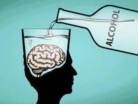 Lạm dụng rượu bia gây teo não, mất trí nhớ